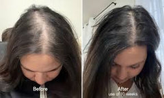 Caffeine and Rosemary Hair Growth Oil