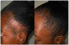 Caffeine and Rosemary Hair Growth Oil